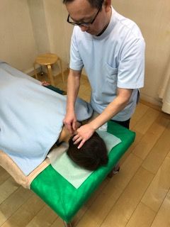 首の鍼灸施術